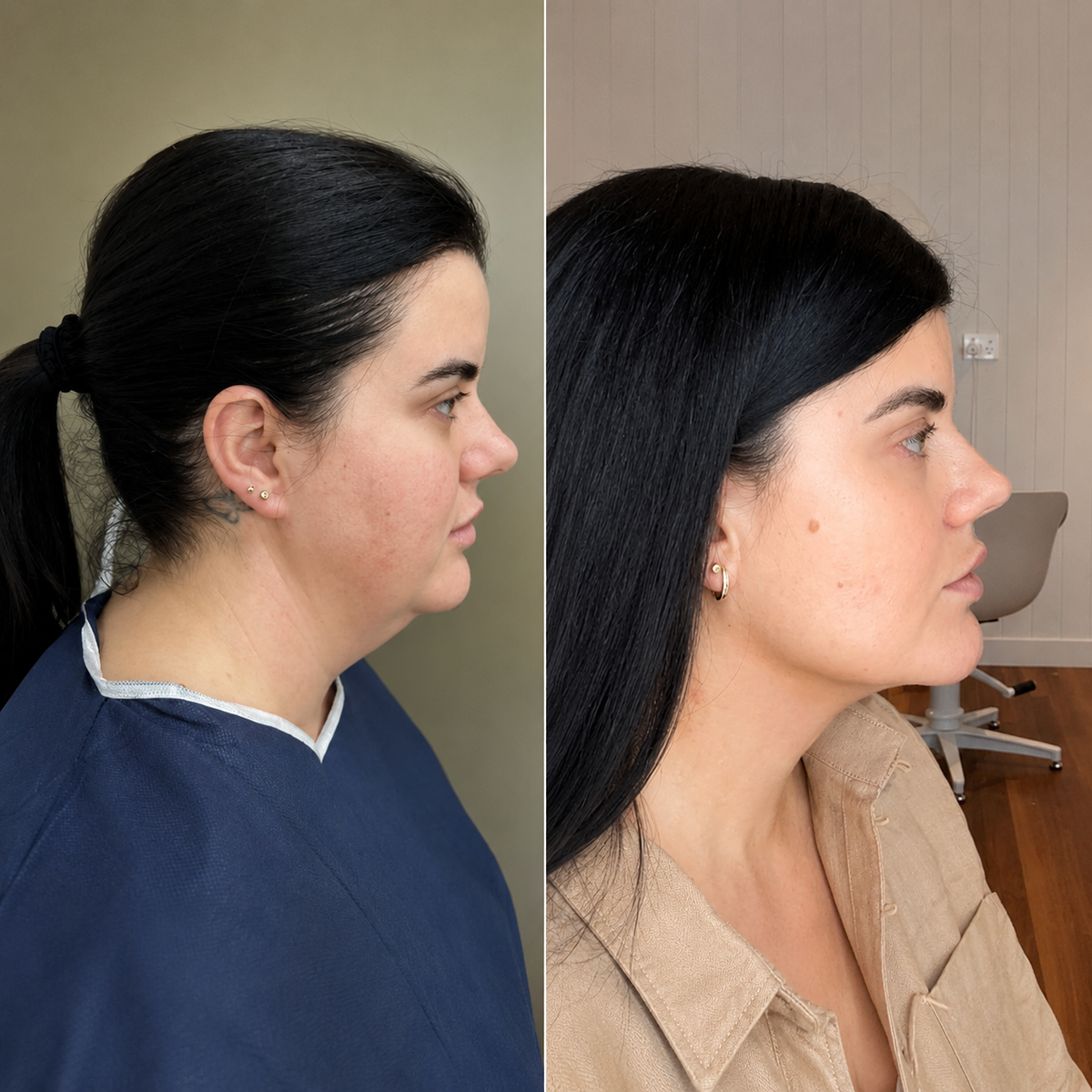Before and after for Emily