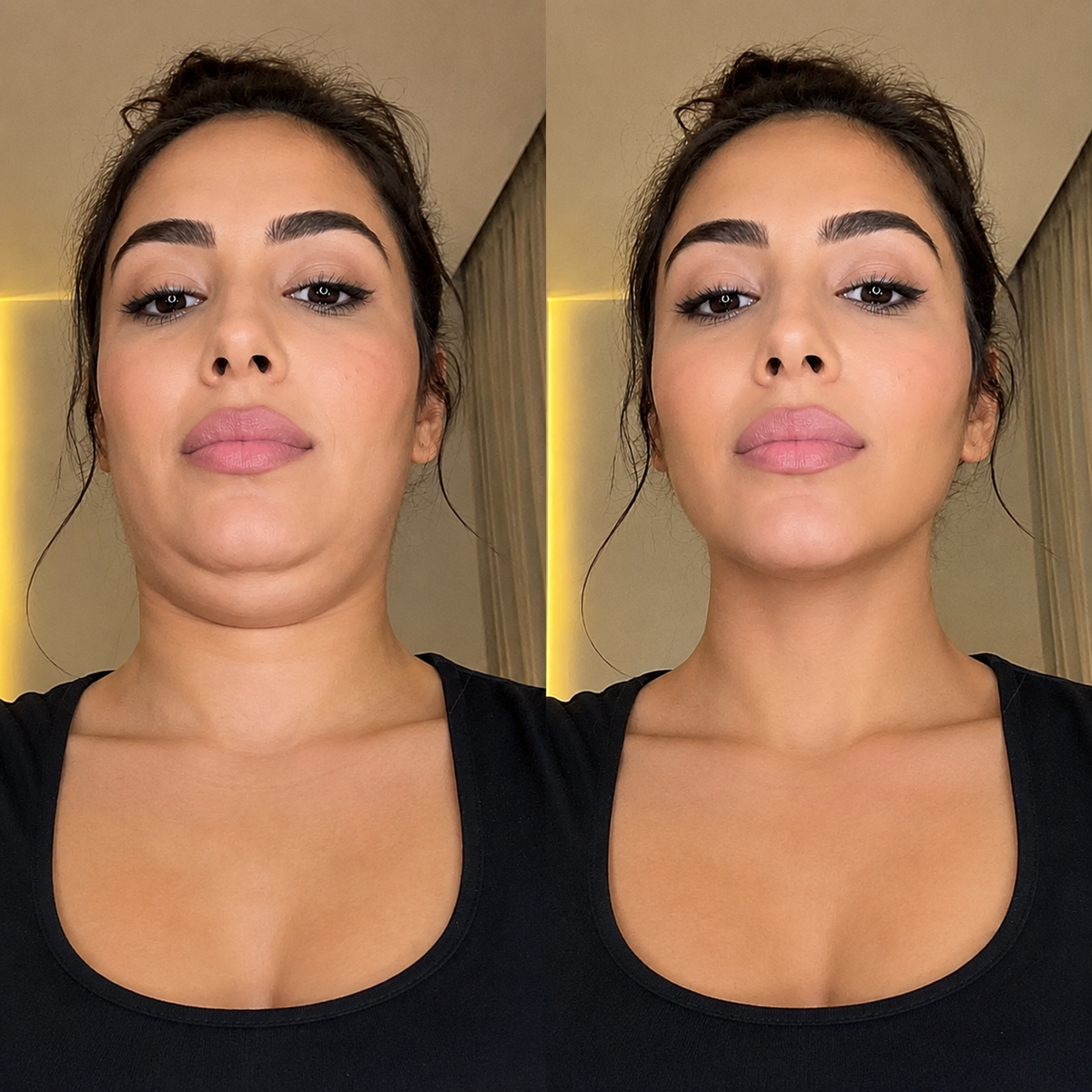 Before and after for Fatima
