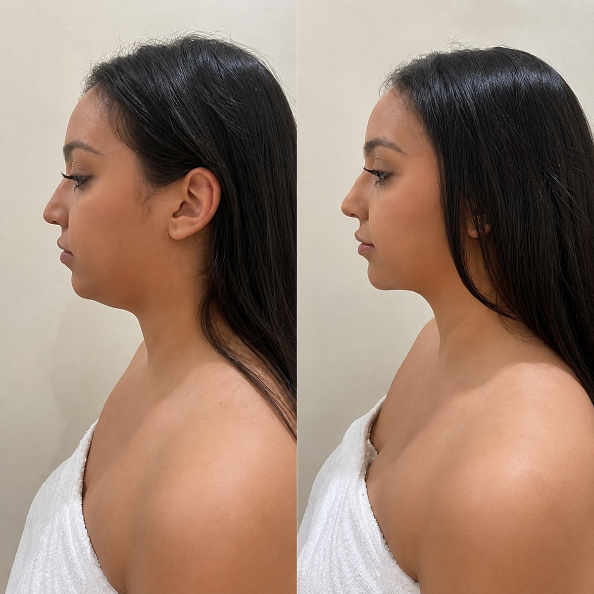 Before and after for Sophia