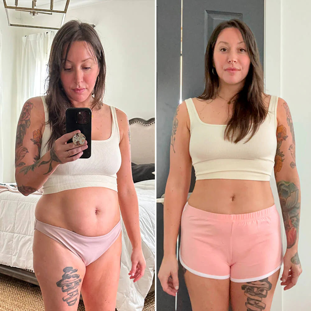 Before and after for Emily