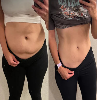 Before and after for Mia