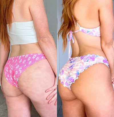 Before and after for Sophia