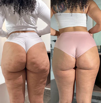 Before and after for Sana