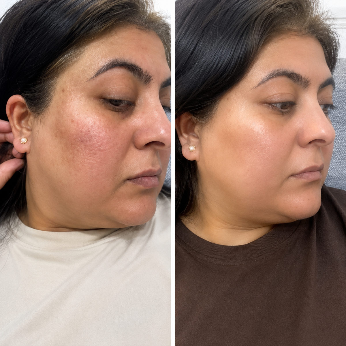 Before and after for Fatima